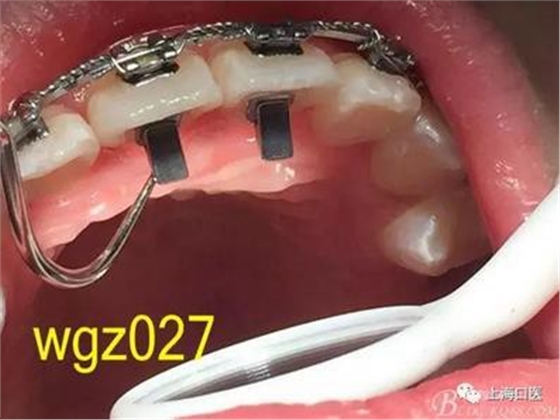 360截圖20170125142325792.jpg 360截圖20170125142325792.jpg