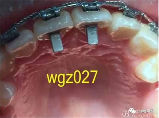 360截圖20170125142332696.jpg 360截圖20170125142332696.jpg