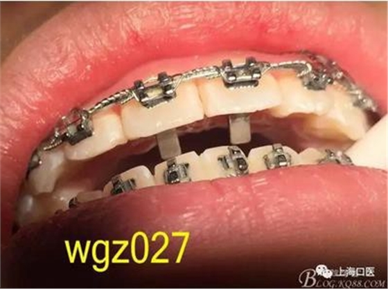 360截圖20170125142341926.jpg 360截圖20170125142341926.jpg