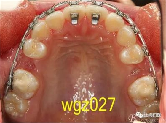 360截圖20170125142348675.jpg 360截圖20170125142348675.jpg