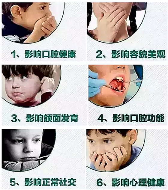 F[F}X$0[(56J_MMOU5VWP4V.png F[F}X$0[(56J_MMOU5VWP4V.png