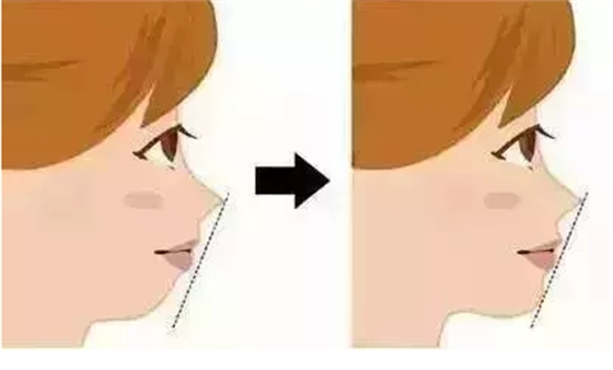 @`GV0$UMXBLZJ7U)U%}J{DA.png @`GV0$UMXBLZJ7U)U%}J{DA.png