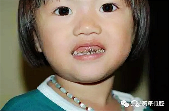 E0H@%97AZ)B(M{2UL8J4%DU.png E0H@%97AZ)B(M{2UL8J4%DU.png