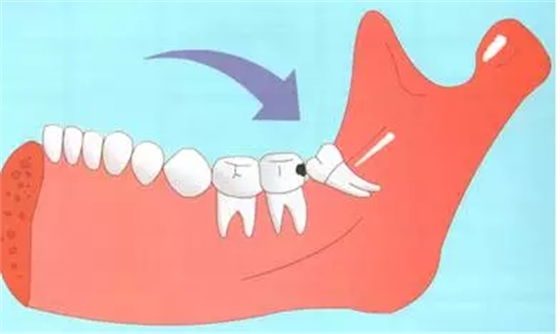 48DH4`@A(37KWTZG~RI5(@I.png 48DH4`@A(37KWTZG~RI5(@I.png