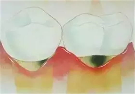 QW@27)_KOJ{BPVM18DZ4UD4.png QW@27)_KOJ{BPVM18DZ4UD4.png