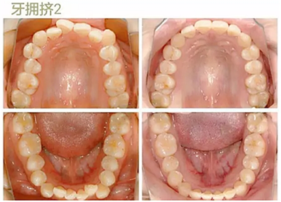 JA$Y`W1Q$4I_LOM6I9UXQTB.png JA$Y`W1Q$4I_LOM6I9UXQTB.png