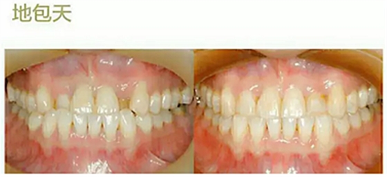 G86ZKQGLT2GP5R}`[UTZ)$K.png G86ZKQGLT2GP5R}`[UTZ)$K.png