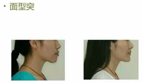 L5M1RH5X5X28}DWF2HF49ZD.png L5M1RH5X5X28}DWF2HF49ZD.png