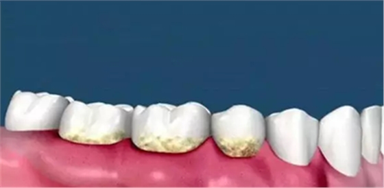 X`YXZT$IKBBFP`E2SF3N}FI.png X`YXZT$IKBBFP`E2SF3N}FI.png