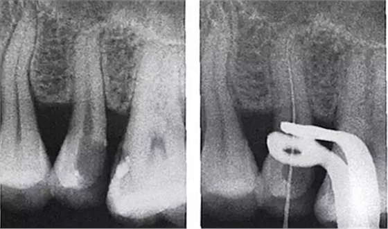 FK2O9E$6TQA~A0}2PG{F{3F.png FK2O9E$6TQA~A0}2PG{F{3F.png