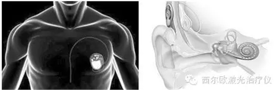 095ZG7HV5QC(2U~65JM7BGM.png 095ZG7HV5QC(2U~65JM7BGM.png