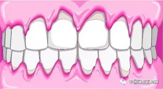 O43MF)G@LF_~}{HW2Q@~LTQ.png O43MF)G@LF_~}{HW2Q@~LTQ.png