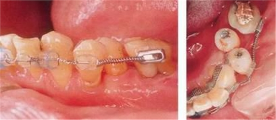 360截圖20170422101820545.jpg 360截圖20170422101820545.jpg