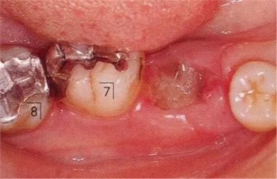 360截圖20170422101957225.jpg 360截圖20170422101957225.jpg