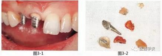 360截圖20170422121128058.jpg 360截圖20170422121128058.jpg