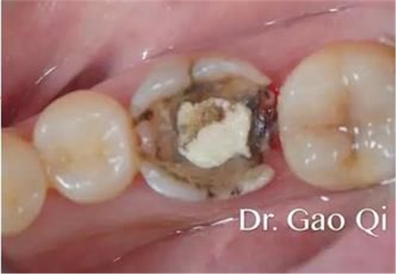 360截圖20170422163741659.jpg 360截圖20170422163741659.jpg