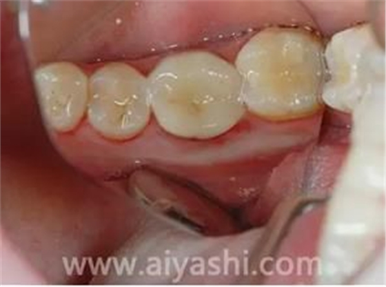 360截圖20170422163843299.jpg 360截圖20170422163843299.jpg