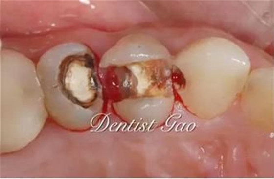 360截圖20170422165004854.jpg 360截圖20170422165004854.jpg