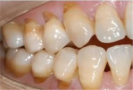 360截圖20170422185117755.jpg 360截圖20170422185117755.jpg