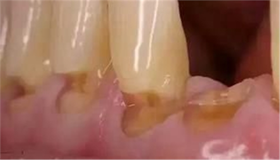 360截圖20170422184706826.jpg 360截圖20170422184706826.jpg