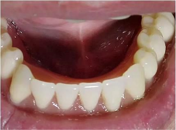 360截圖20170422191407148.jpg 360截圖20170422191407148.jpg