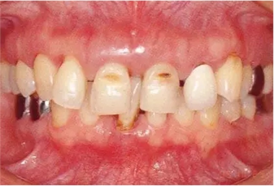 2222222222.png 2222222222.png