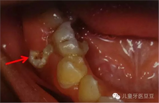 0IG~(~2ELPN~$0HI(Q[)2$6.png 0IG~(~2ELPN~$0HI(Q[)2$6.png