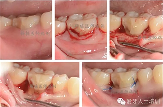 KRAJK0`J9){U)_K0F[`OSUY.png KRAJK0`J9){U)_K0F[`OSUY.png