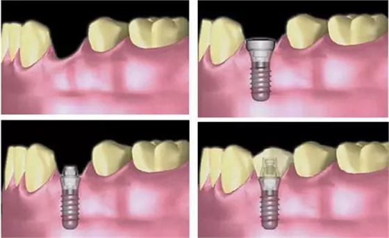 H}_S[}V[6CL~XUQ(F)WXGBB.png H}_S[}V[6CL~XUQ(F)WXGBB.png