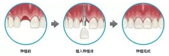 ~T[ONV3MRE5@PGA)@X_R~I3.png ~T[ONV3MRE5@PGA)@X_R~I3.png