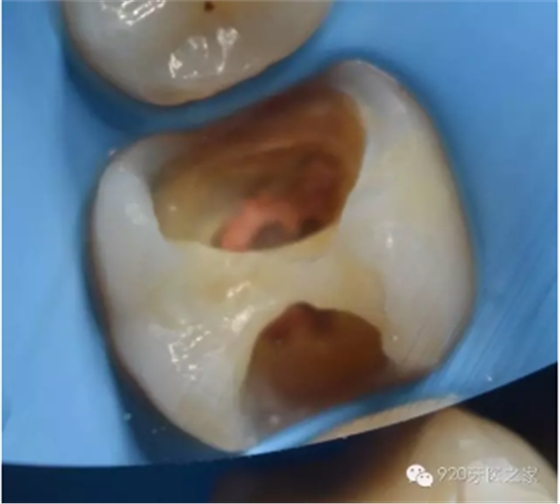 %30SPK[BJ6O7%77YTIB3SI0.png %30SPK[BJ6O7%77YTIB3SI0.png