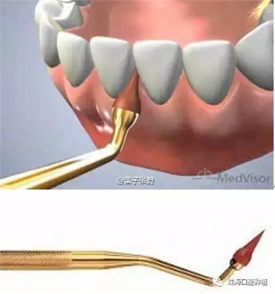 B)YH0RCAT_L)O[`TA3JIWXL.png B)YH0RCAT_L)O[`TA3JIWXL.png