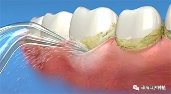 X%DAF4(93OR51WEBGBX@UI6.png X%DAF4(93OR51WEBGBX@UI6.png