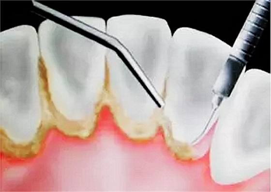 J`H_YAG{N01WB$84MP6$6JQ.png J`H_YAG{N01WB$84MP6$6JQ.png