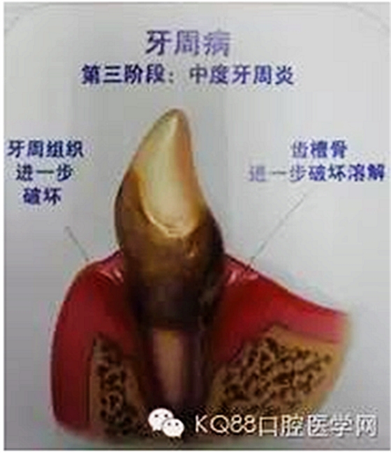 (IL_FGBGHN2_ZUM04~OO4K2.png (IL_FGBGHN2_ZUM04~OO4K2.png