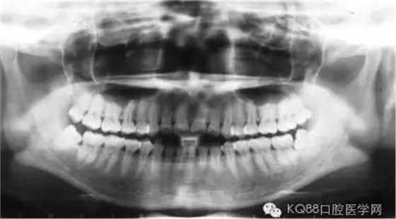 BCO9X${YYWGRCB3B6D55)RM.png BCO9X${YYWGRCB3B6D55)RM.png