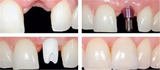 640.webp (8).jpg 640.webp (8).jpg