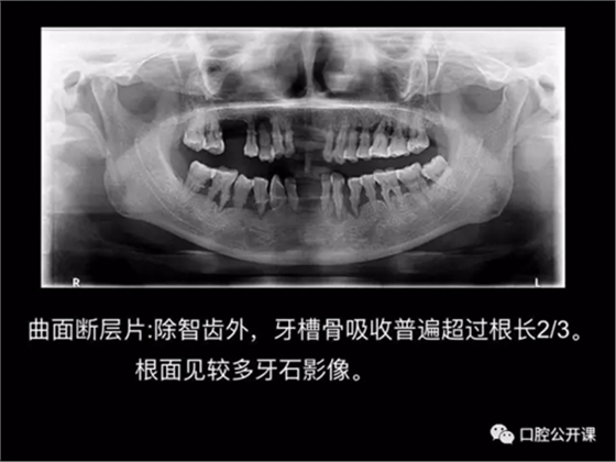 10.webp.jpg 10.webp.jpg