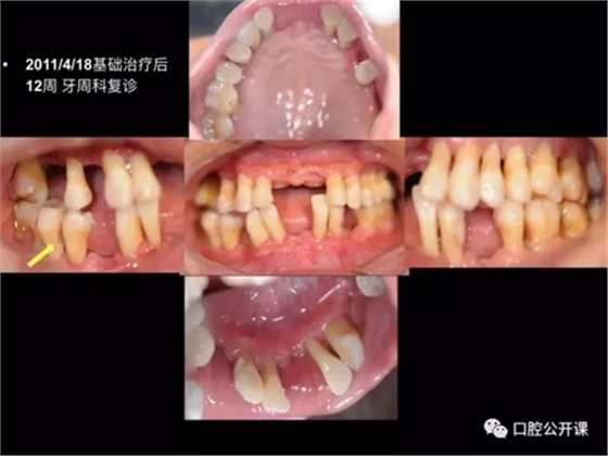 13.webp.jpg 13.webp.jpg