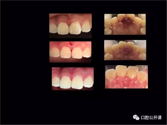 20.webp.jpg 20.webp.jpg