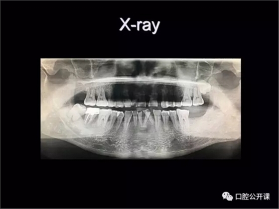 25.webp.jpg 25.webp.jpg