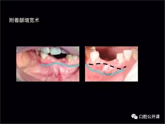 28.webp.jpg 28.webp.jpg