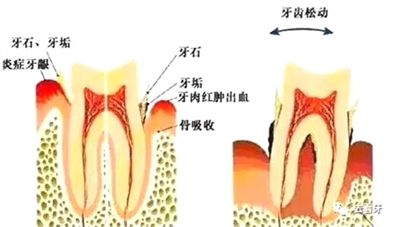 15.webp.jpg 15.webp.jpg