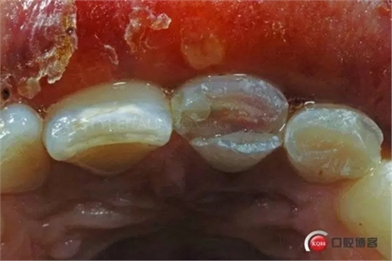 2.webp.jpg 2.webp.jpg