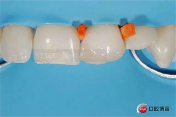 17.webp.jpg 17.webp.jpg