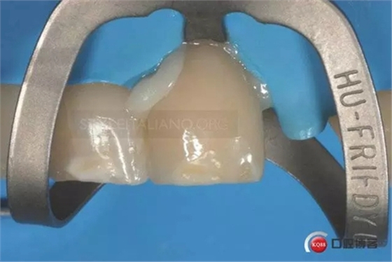 25.webp.jpg 25.webp.jpg