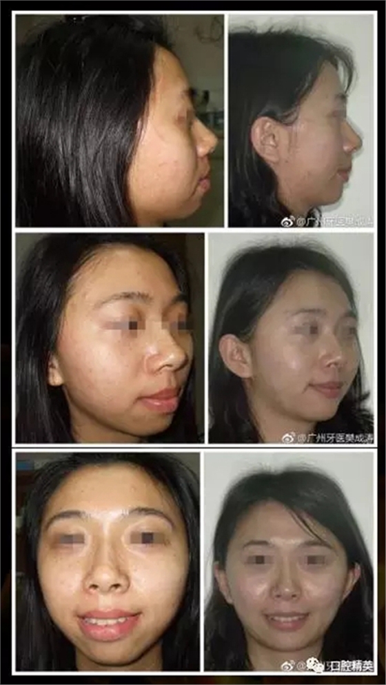 14.webp.jpg 14.webp.jpg