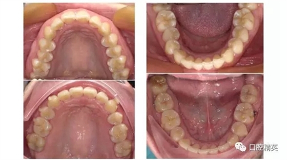 18.webp.jpg 18.webp.jpg