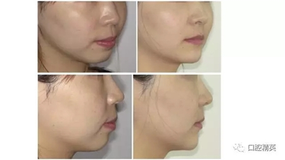 20.webp.jpg 20.webp.jpg