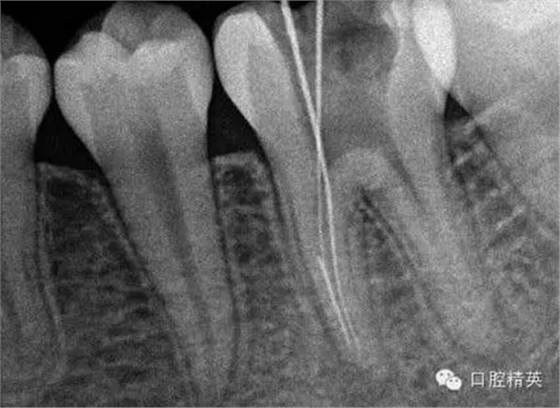 5.webp.jpg 5.webp.jpg